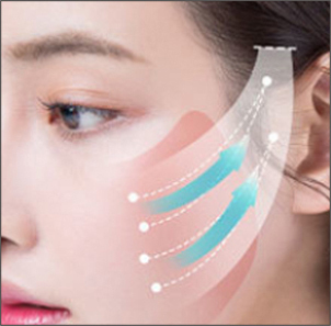 Step 3 lifting and removing sagging skin with careful adjustment of skin tightening in micro facelift at NANA