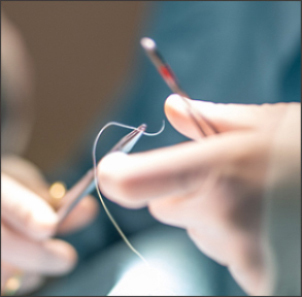 Step 4 finely suturing the hairline incision to complete the micro facelift procedure at NANA