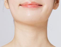Step 1 making a 1cm incision below the chin for plate-shaped neck lifting in platysmaplasty at NANA