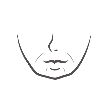 Thread lifting for sagging due to reduced elasticity and aging at NANA Plastic Surgery Korea