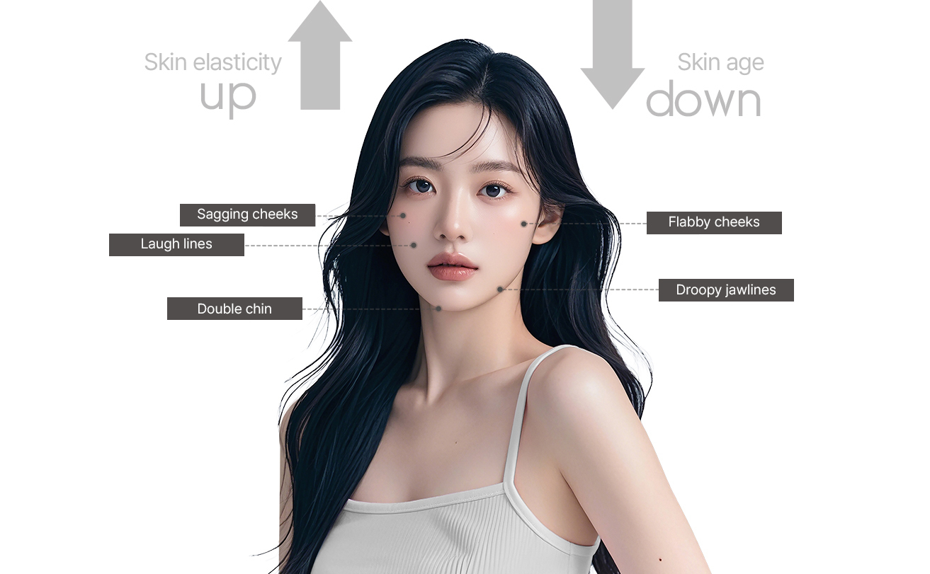 Thread lifting procedure areas at NANA Plastic Surgery including cheeks jawline nasolabial folds and neck