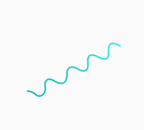 Ultra V Whirl Thread shape for thread lifting at NANA Plastic Surgery Korea