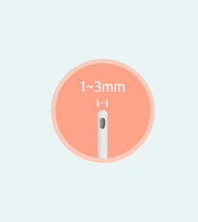 Micro cannula 1 to 3mm used for mini liposuction at NANA Plastic Surgery Korea