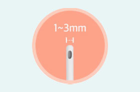 Micro cannula 1 to 3mm used for mini liposuction at NANA Plastic Surgery Korea