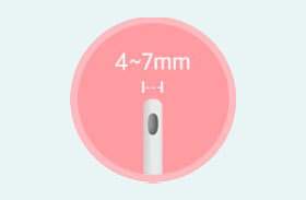 Standard cannula 4 to 7mm compared to micro cannula for full body liposuction at NANA