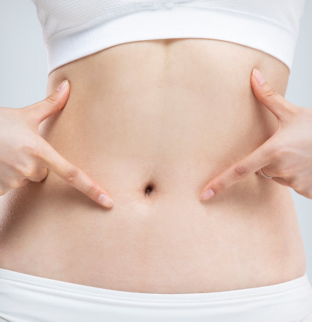 Tummy tuck quick recovery with no suture removal using special sutures and medical adhesive at NANA