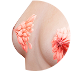 Duct preservation method for nipple surgery Korea