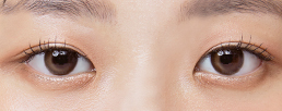 Innocent-looking thin inner line double eyelid with starting point slightly covered in front at NANA
