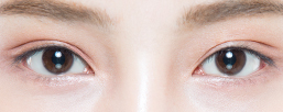 Cool and well-defined outer line double eyelid beginning above the front of the eye for exotic appearance at NANA