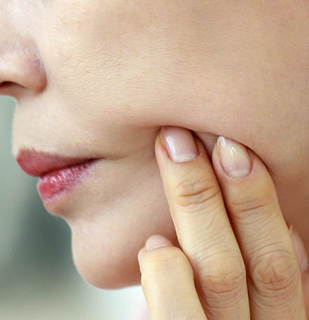 Mid facelift case 4 sagged cheeks requiring repositioning through mid face lift at NANA
