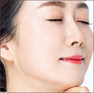 Step 4 suturing the under-eye incision closed after mid facelift at NANA Plastic Surgery