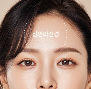 Step 2 diagonal incision to protect supraorbital nerve and hair follicles