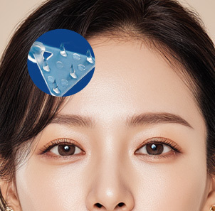 Step 3 Endotine placement for secure forehead fixation