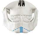 S osteotomy technique for low nerve line jaw surgery at NANA