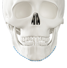 Step 3 final bone excision and securing for chin lengthening