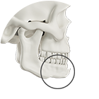 Chin tip advancement bone surgery illustration