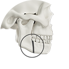 Mandibular advancement surgery illustration