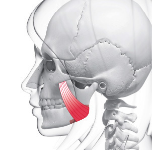 Quick zygoma reduction step 3 rear lateral zygoma pushed inward without bone removal at NANA Korea