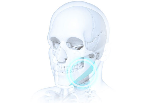 Quick zygoma reduction 360-degree facial analysis for customized surgical plan at NANA Korea
