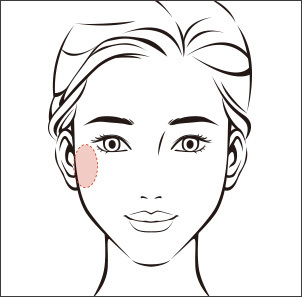 Cheekbone fat removal to reduce bulging cheek appearance at NANA