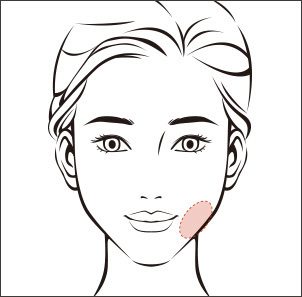 Buccal fat pad removal for defined facial contour at NANA Plastic Surgery