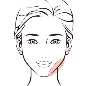 Jawline fat removal to enhance and define the jaw at NANA Plastic Surgery