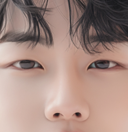 Male eye surgery recommended for men whose eyes look tired due to weak eyelid strength at NANA Korea