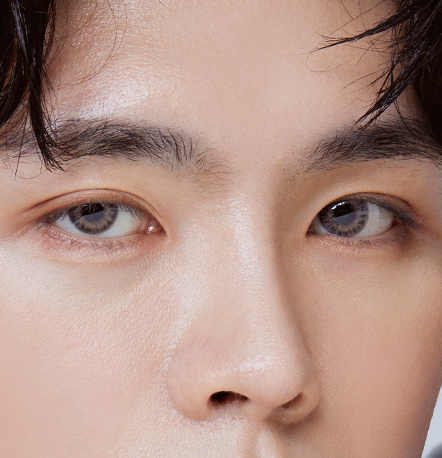 Male eye surgery recommended for men with overly pronounced or unnatural double eyelid line at NANA