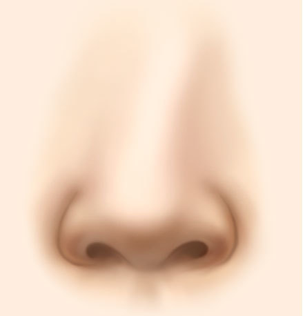 deviated nose correction with rhinoplasty