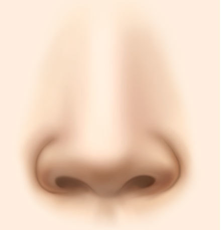 wide nose reduction rhinoplasty
