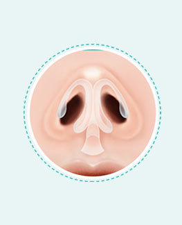 CT scan evaluation of nasal deviation and septal structure
