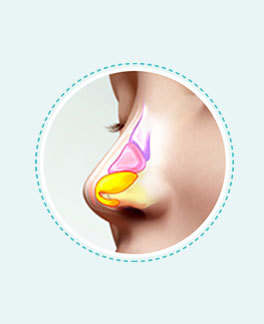 3D CT analysis of nasal bone size and shape before rhinoplasty