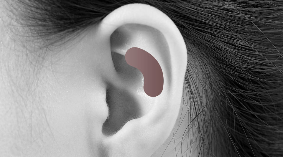 Autologous tissue rhinoplasty case photo 1 at NANA Plastic Surgery Korea