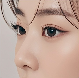 Step 4 achieving a smooth elegant nasal bridge line after hump reduction at NANA